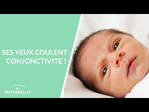 Ses yeux coulent : conjonctivite ? - La Maison des maternelles #LMDM