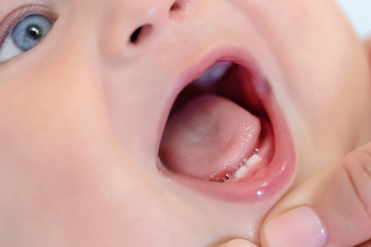 comment savoir si mon bébé fait ses dents