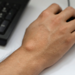 Kyste synovial causes, symptômes et options de traitement