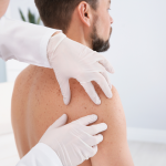 Faut il une ordonnance pour consulter un dermatologue ?