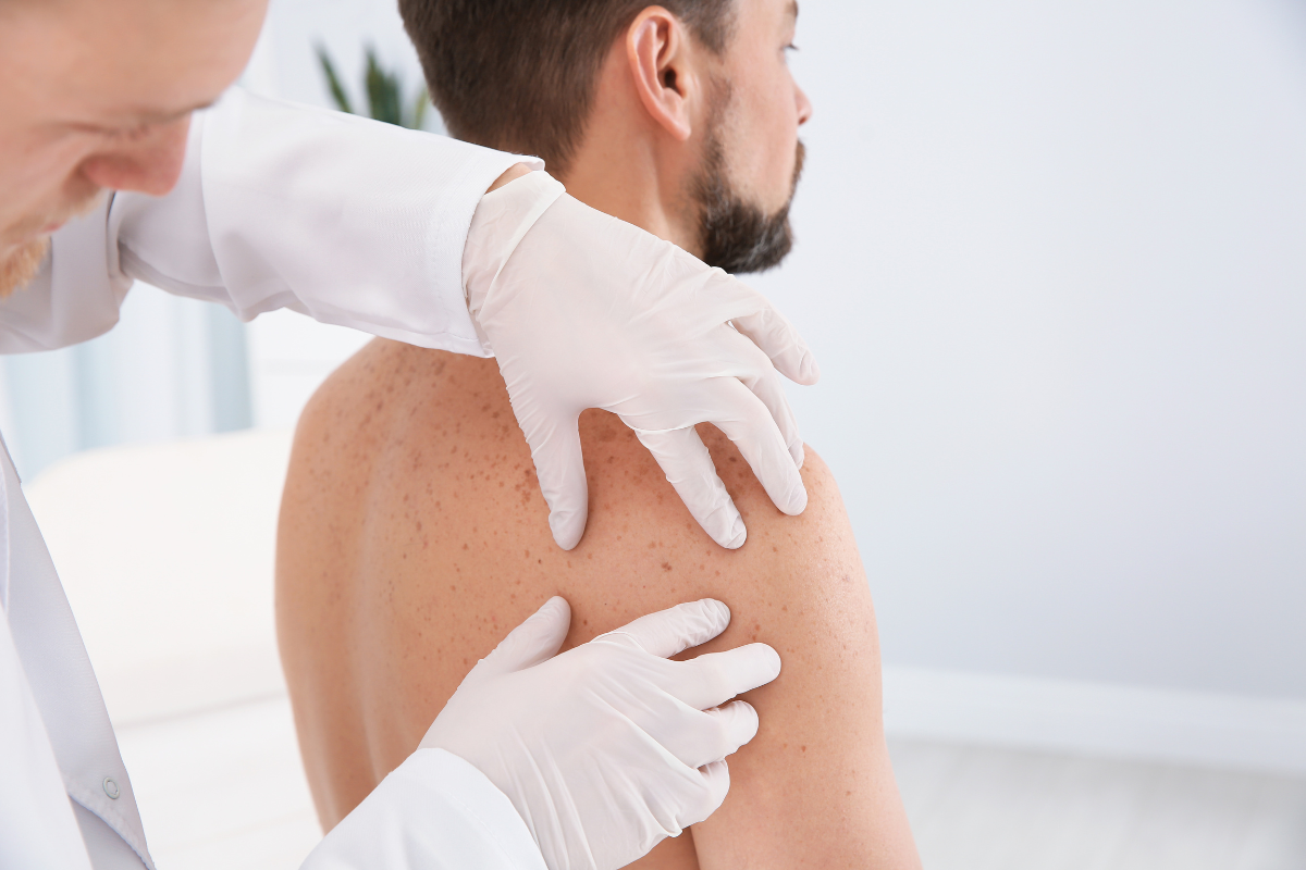 Faut il une ordonnance pour consulter un dermatologue ?